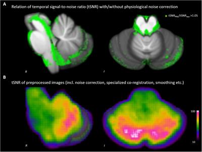 The Use of Physiological Signals in Brainstem/Midbrain fMRI